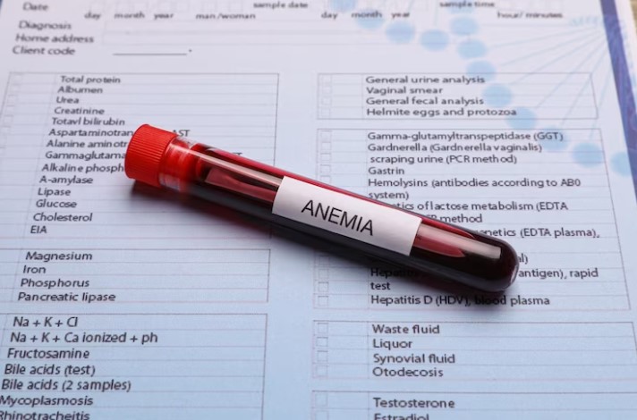 Anaemia